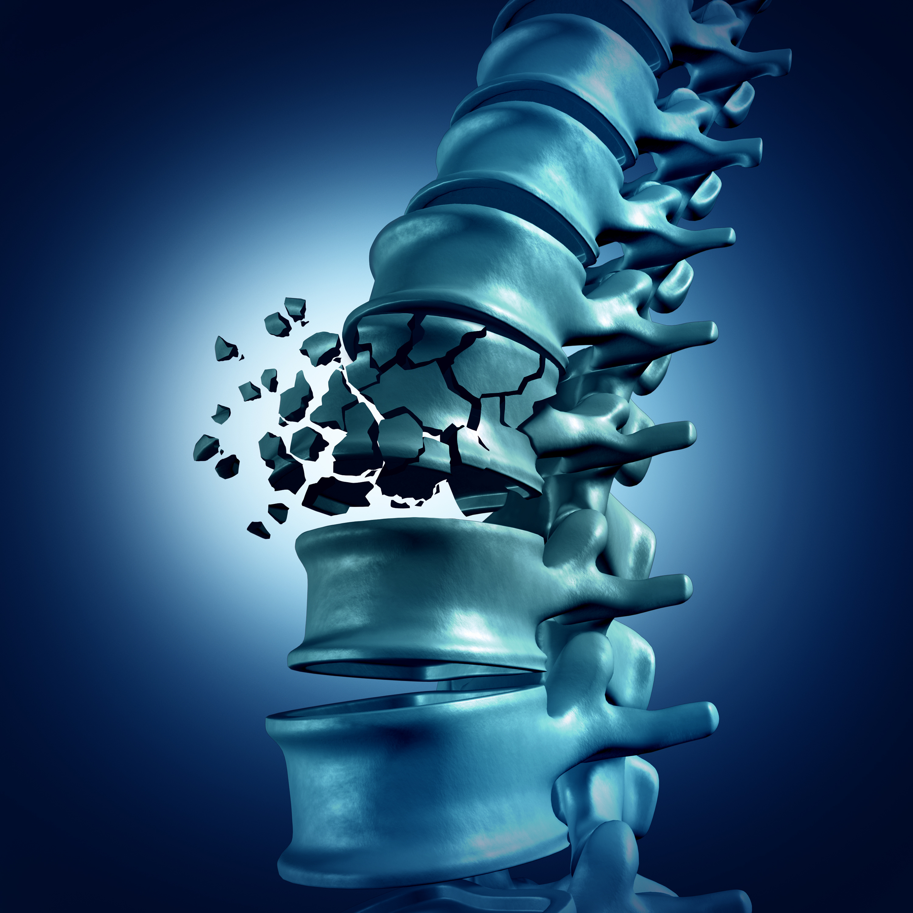 Insights on Osteoporosis