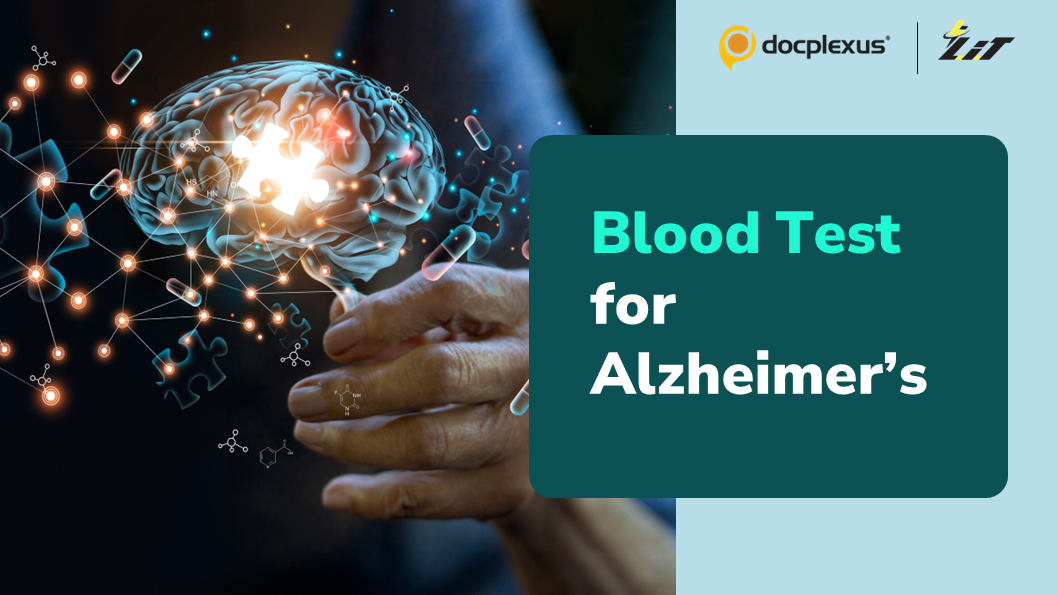 Blood Test to Detect Alzheimer’s Years Before Its Symptoms Emerge