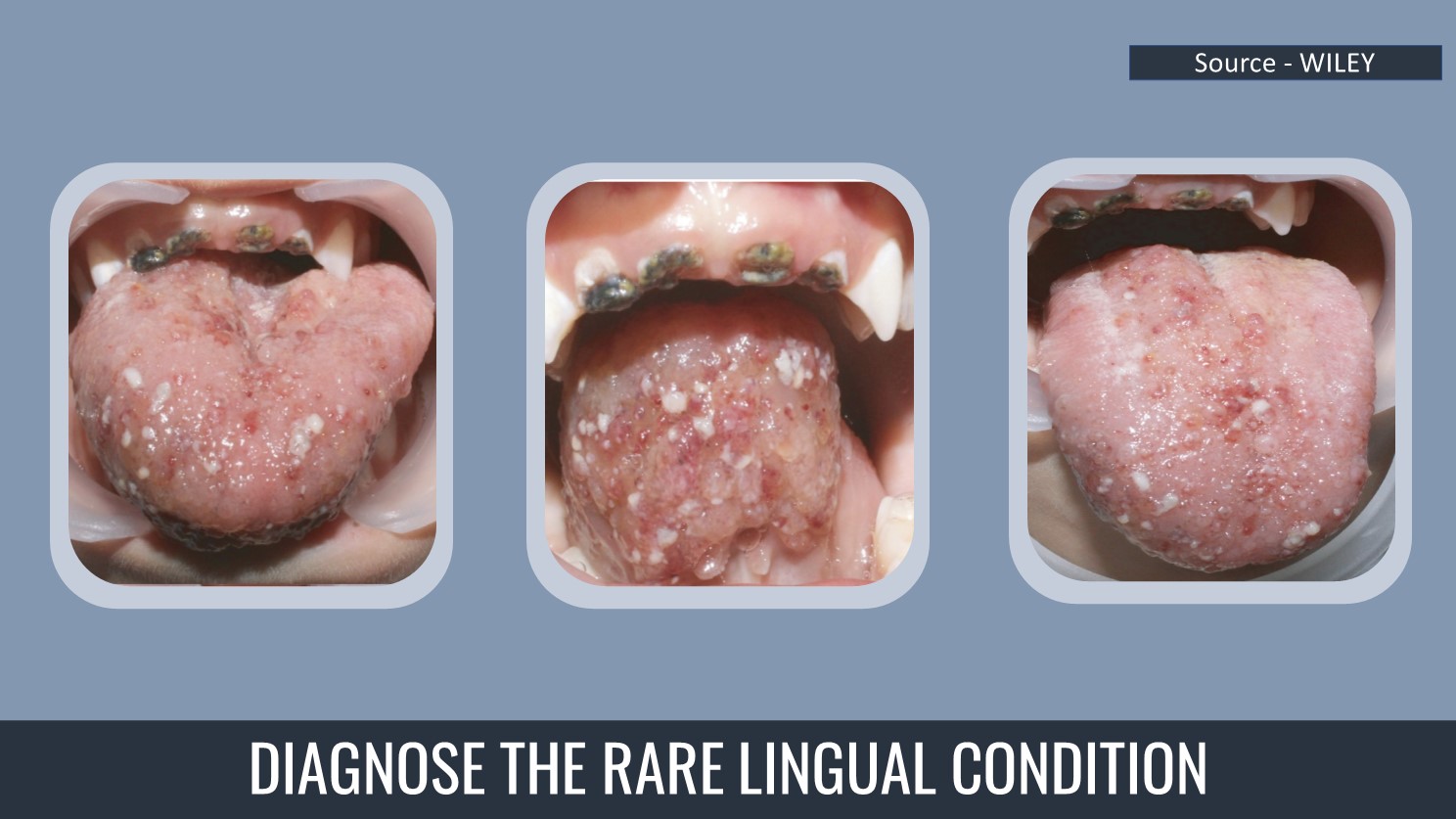 Diagnose This Rare Condition in a 4-year-old