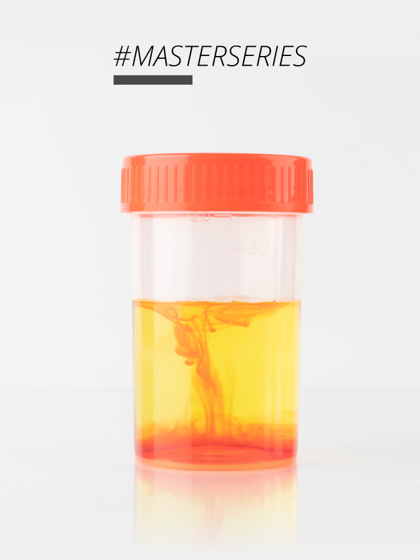 Evaluation and Management of Hematuria