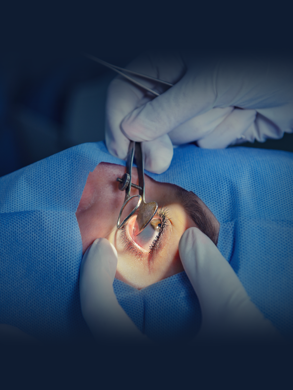 Phakic Lens Implantation For Correction Of Myopia
