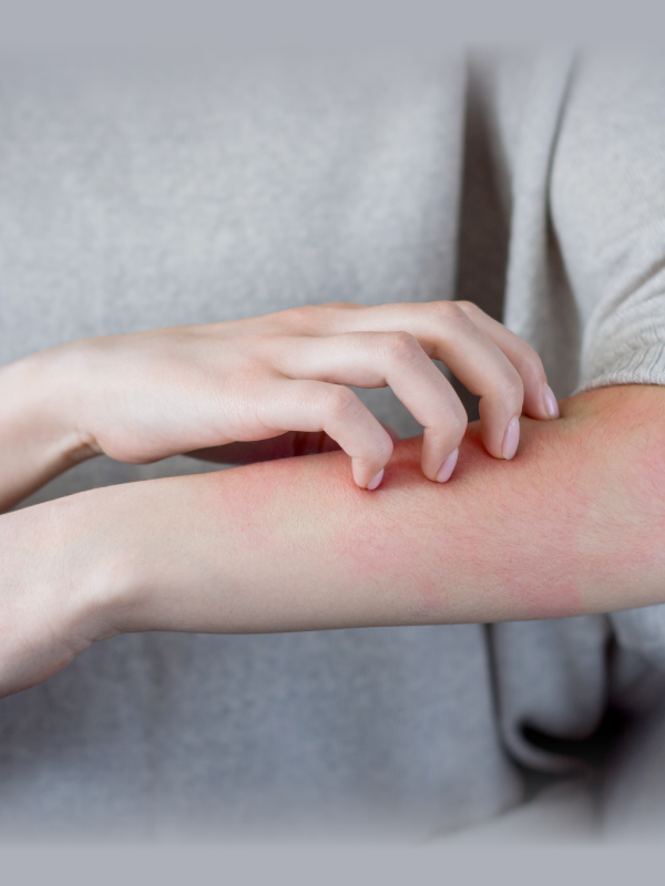 World Skin Health Day