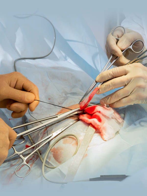 Difficult Laparoscopic Cholecystectomy