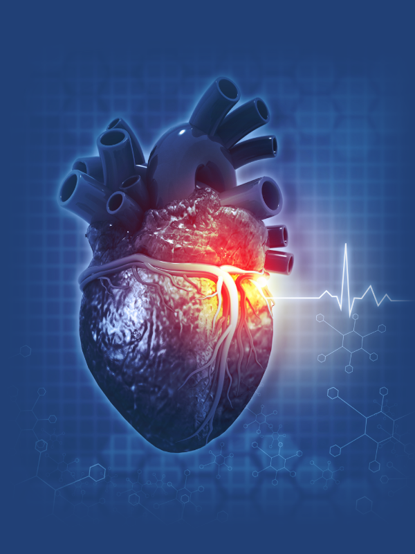 The Radial Artery in CABG - Greatly Improving Results of Surgery