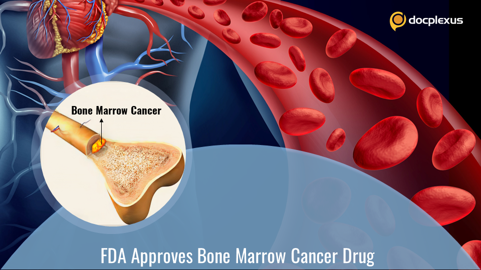 FDA Approves Pacritinib for Bone Marrow Cancer