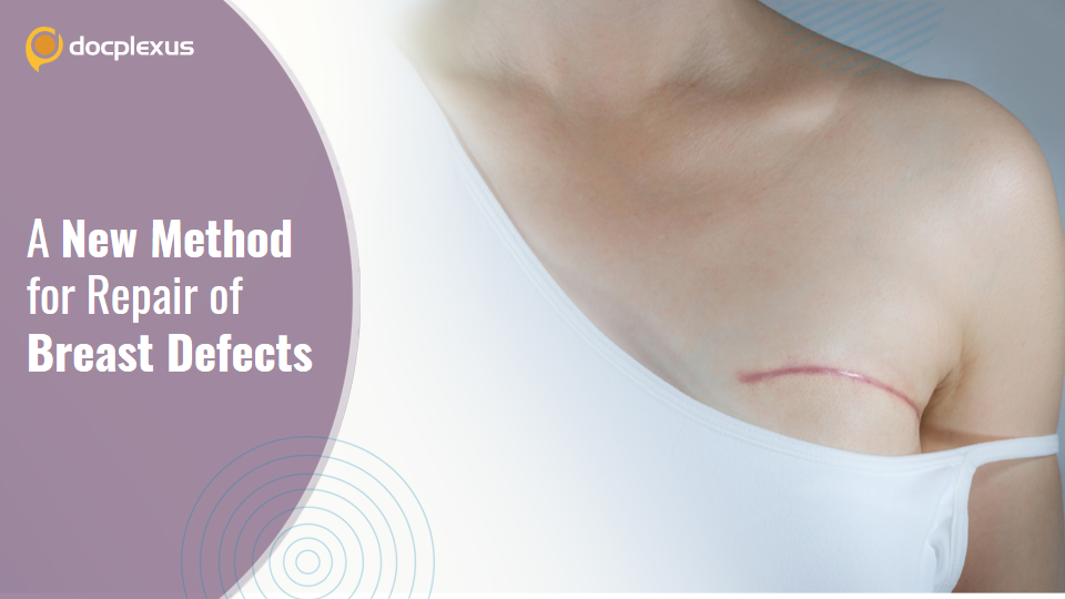 Repairing Unilateral Breast Defect by Contralateral Perforator Flap