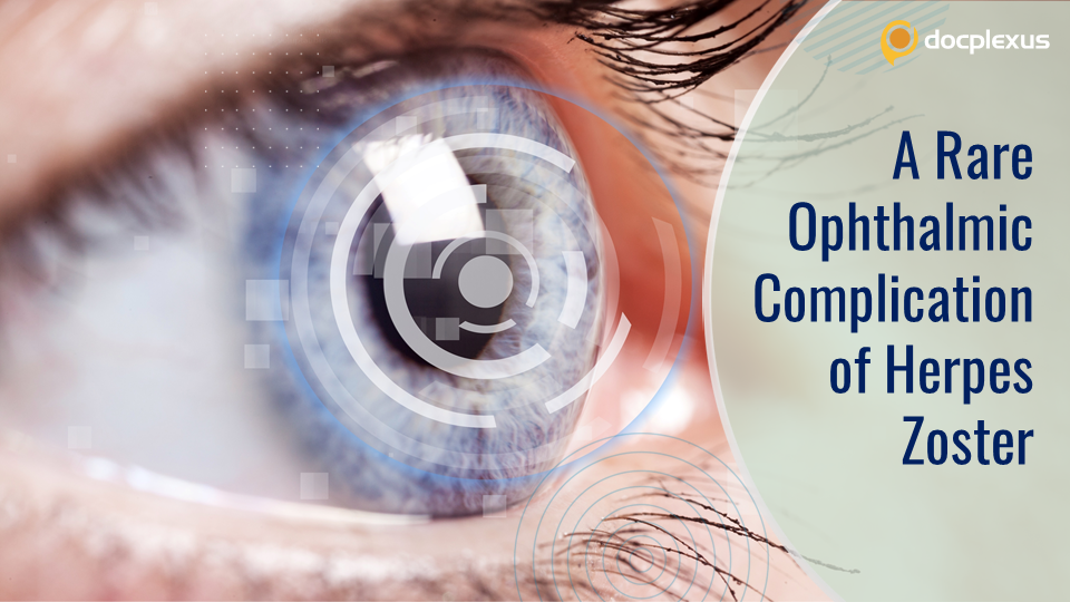 A Rare Cause of Decreased Visual Acuity in an Elderly Female