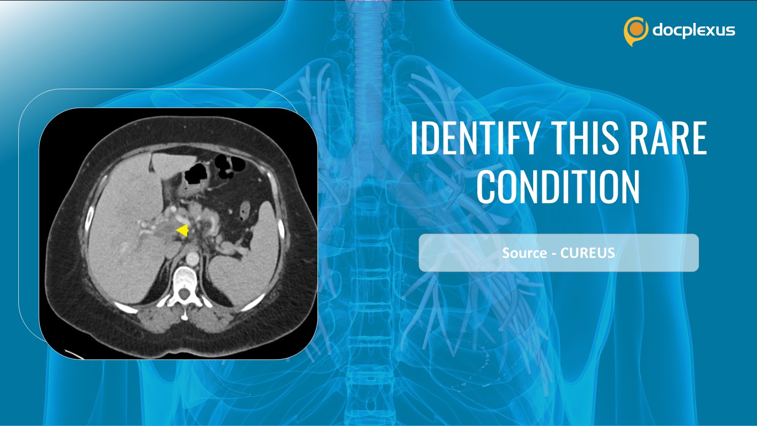 Diagnose This Rare Condition in a COVID-19 Patient