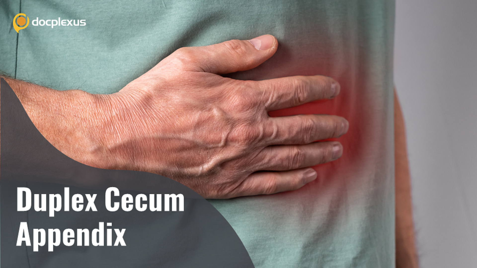 Don’t Miss a Duplex Appendix!