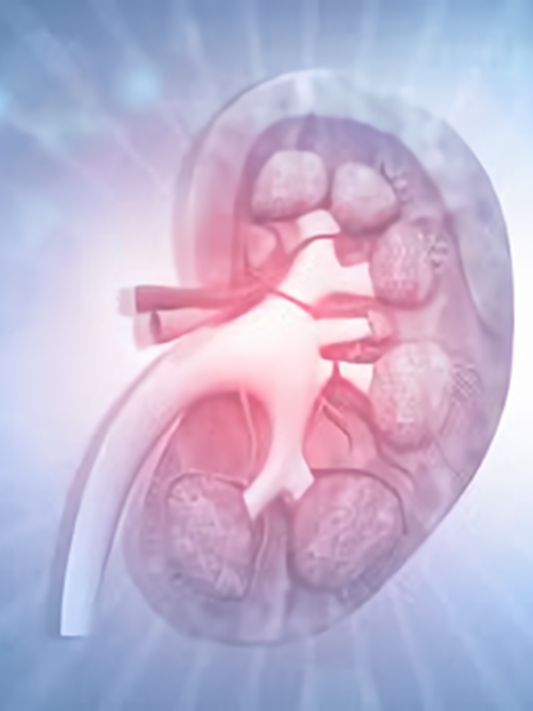 Role of SGLT2 Inhibitors in CKD