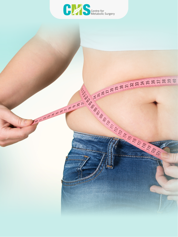 Role of Bariatric Surgery in Obesity