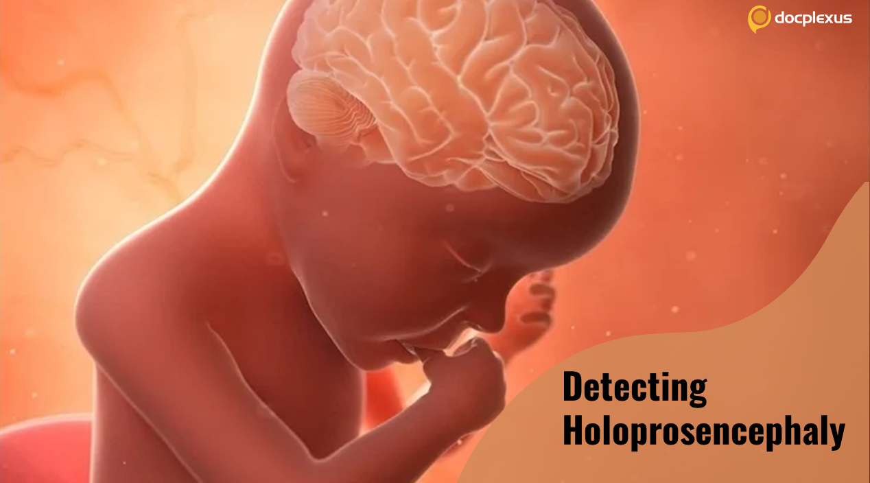 Understanding Holoprosencephaly