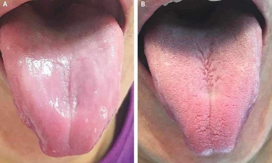 What can be the management of this case?