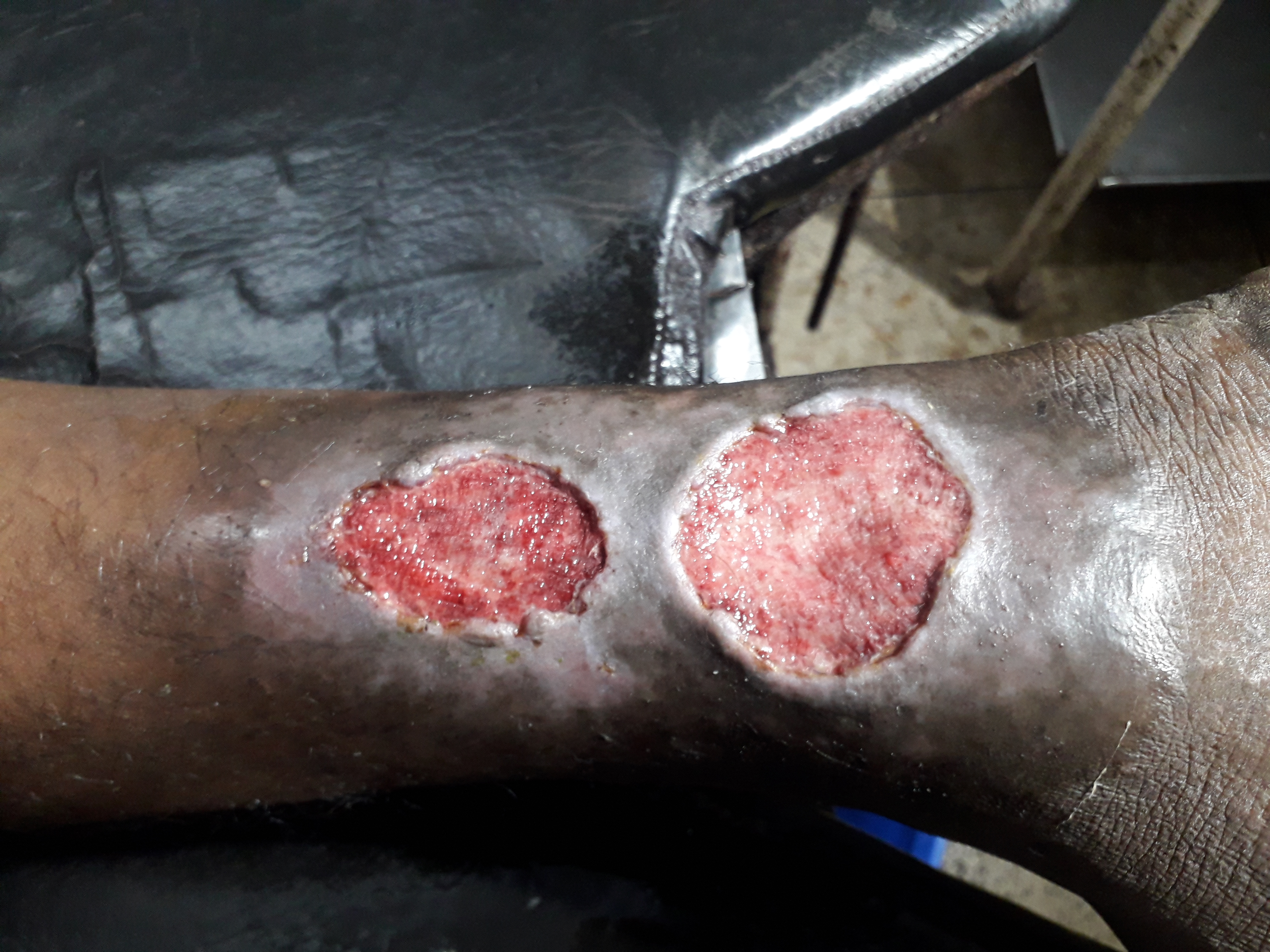 Diagnose This Condition