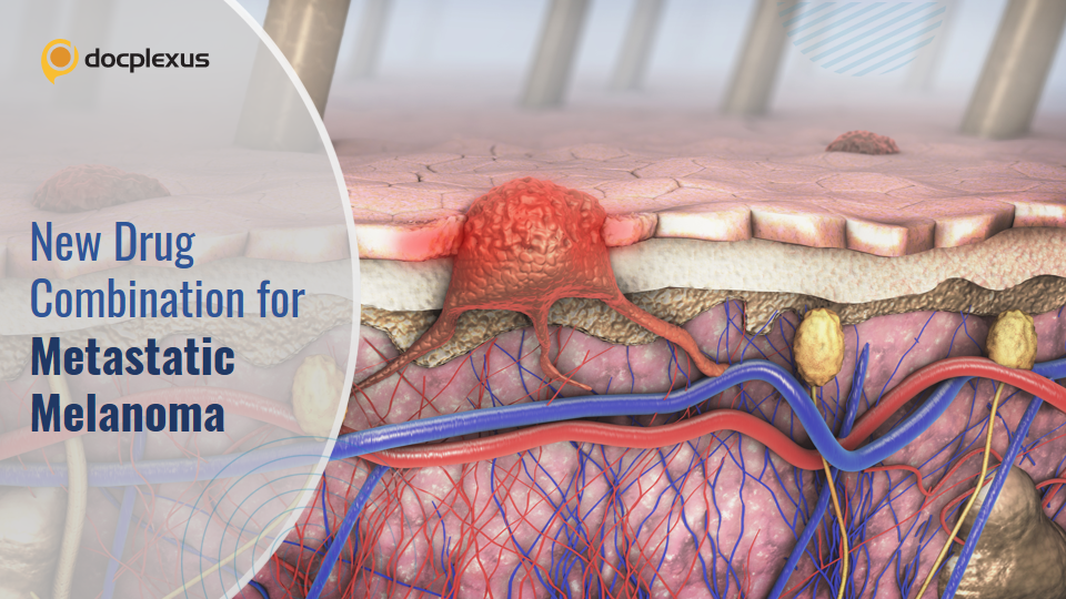 A Combination of Nivolumab and Relatlimab for Untreated Metastatic Melanoma