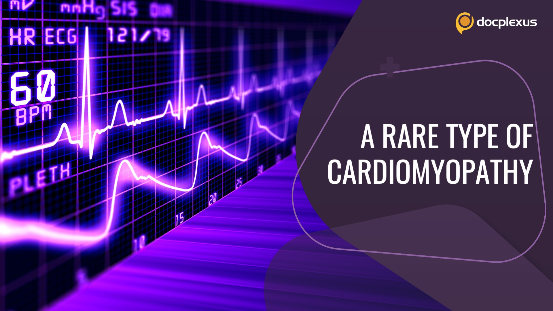 Identify the Type of Cardiomyopathy