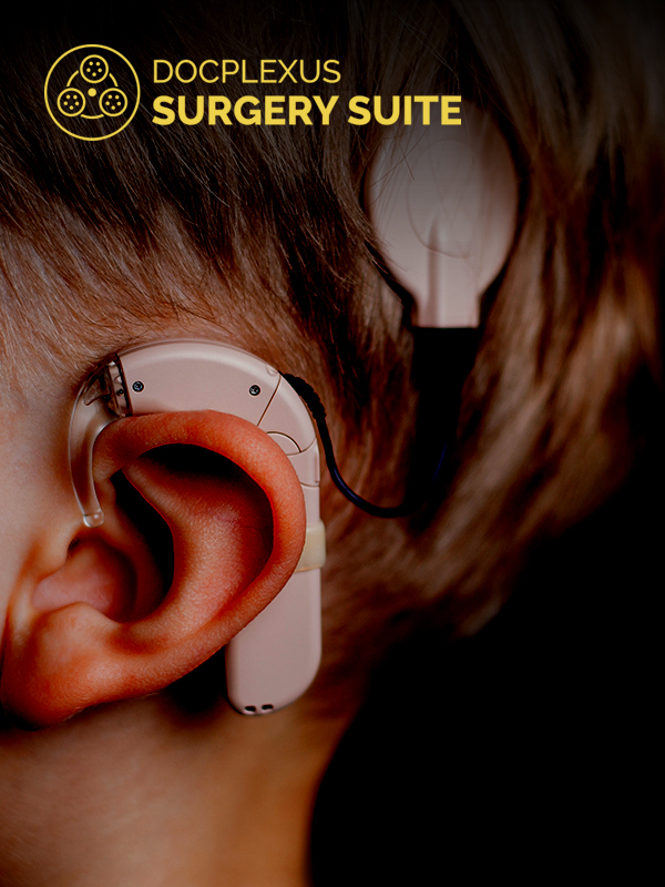 Cochlear implants- why, how and when?