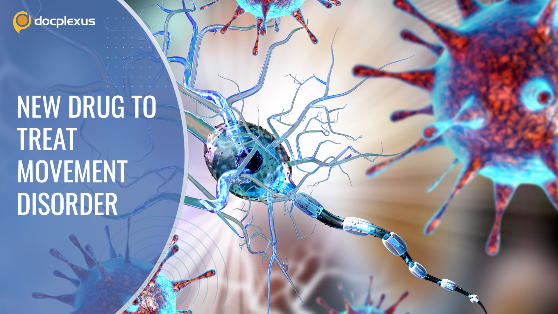 Valbenazine for Huntington’s Disease-related Movement Disorder