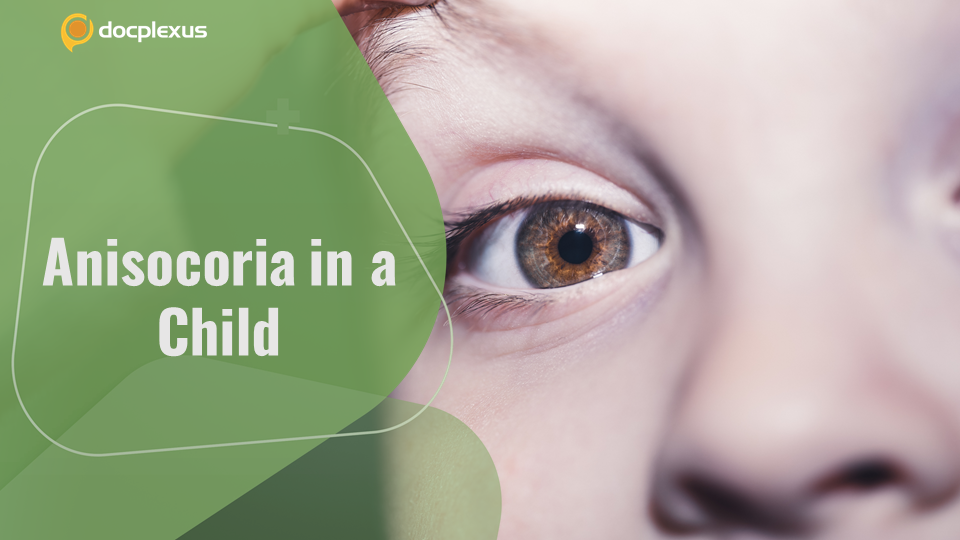 Anisocoria in an 18-month-old Girl