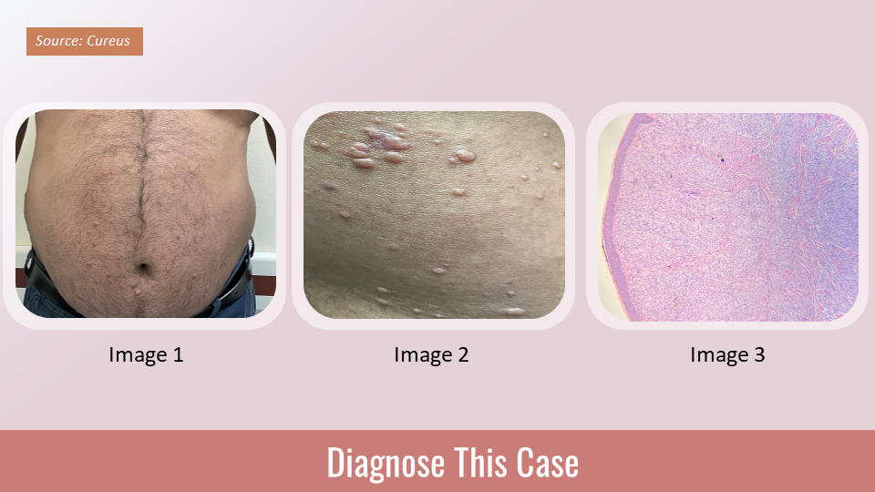 Identify the Cause of Skin Lesions in This Male Patient