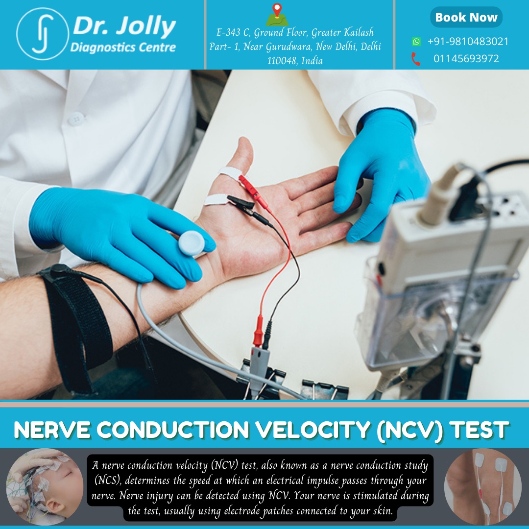 Nerve Conduction Velocity Test