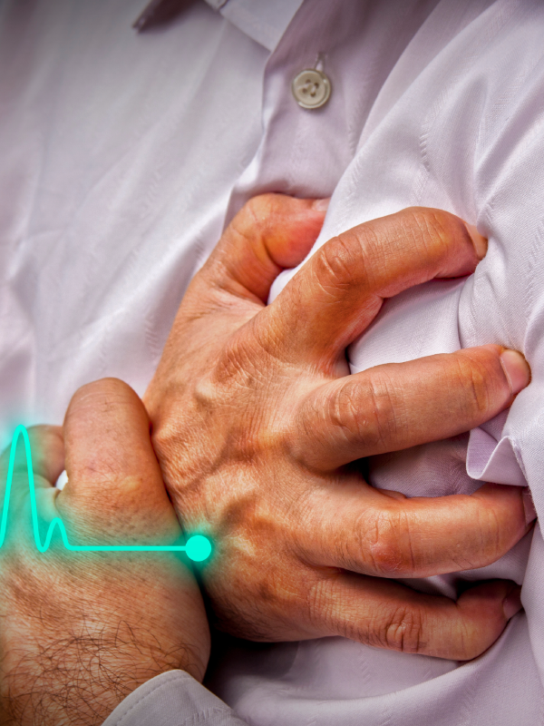 Evaluation and Management of Chest Pain in an OPD Setup
