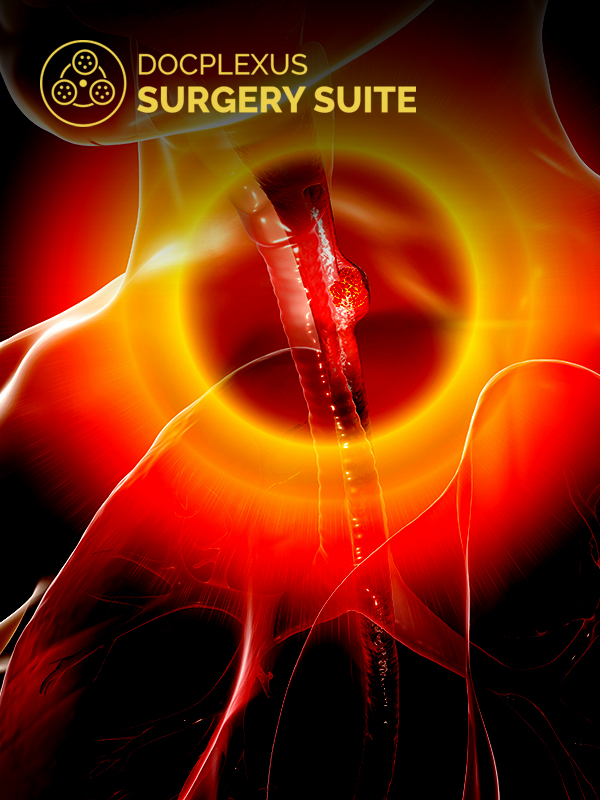Lymphadenectomy in Middle Third Esophagus Carcinoma