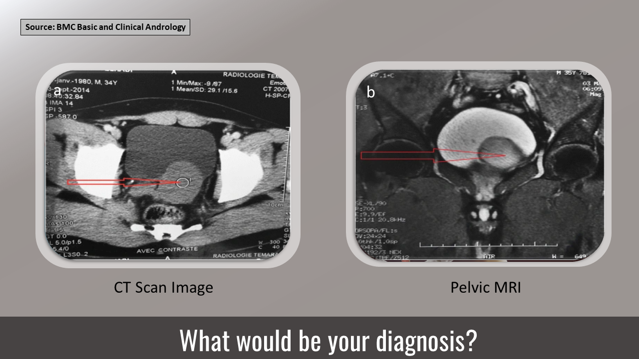 Diagnose This Rare Condition in a Man with Subocclusion