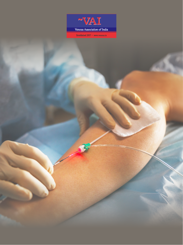 Venous Aneurysms: Do they differ?