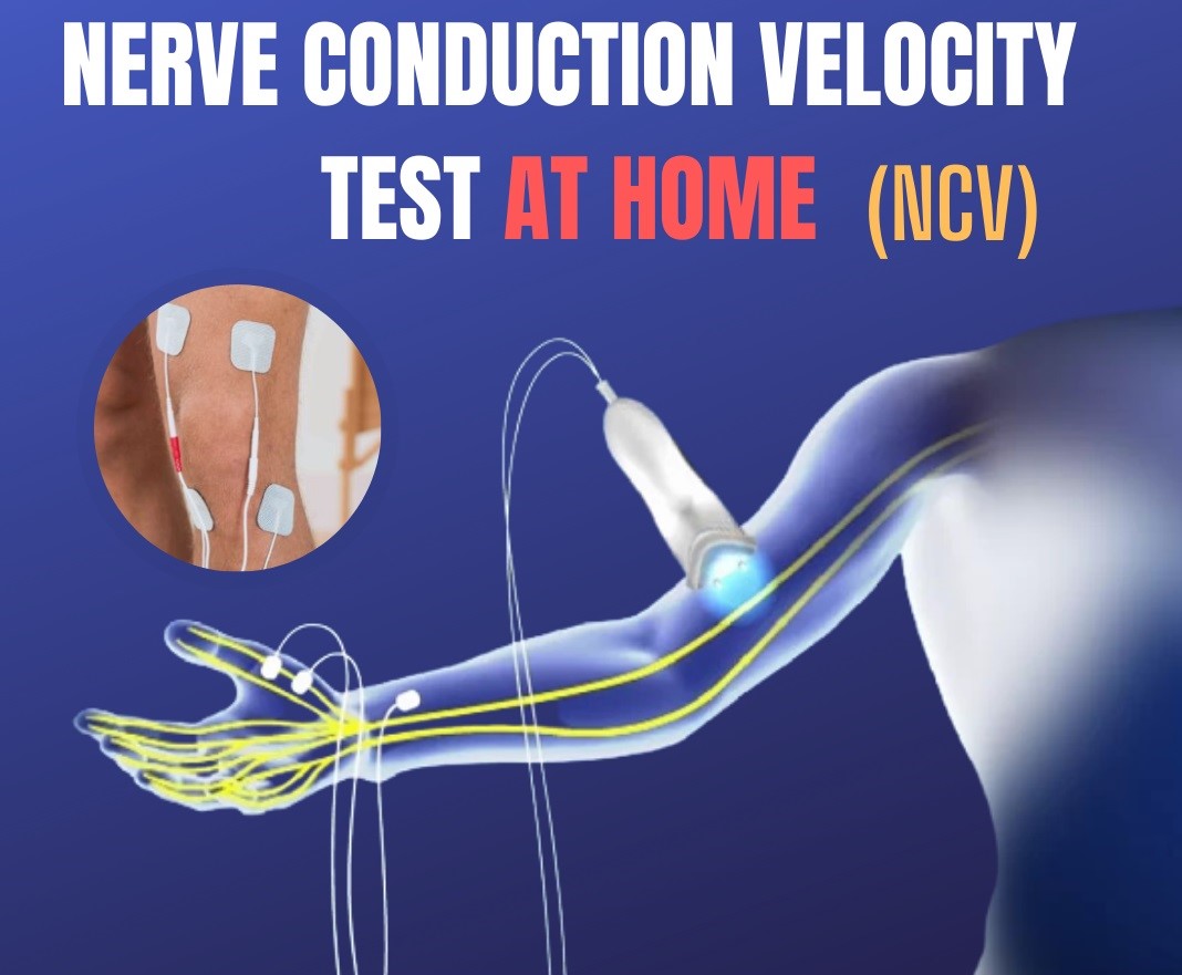 Nerve Conduction Study