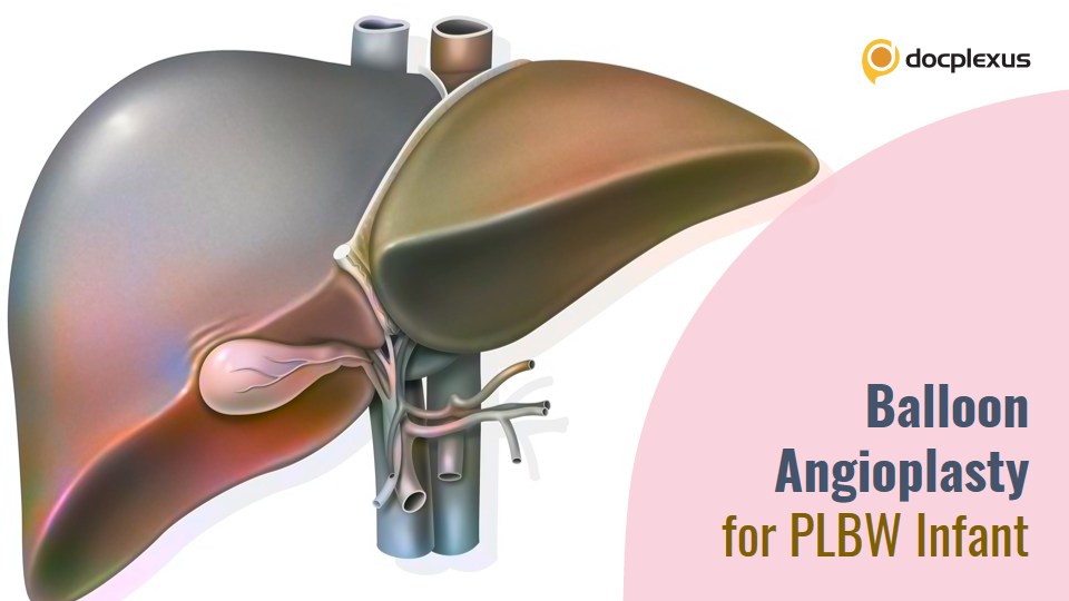 Unconventional Yet Successful – Balloon Angioplasty for Chronic Portal Vein Thrombosis