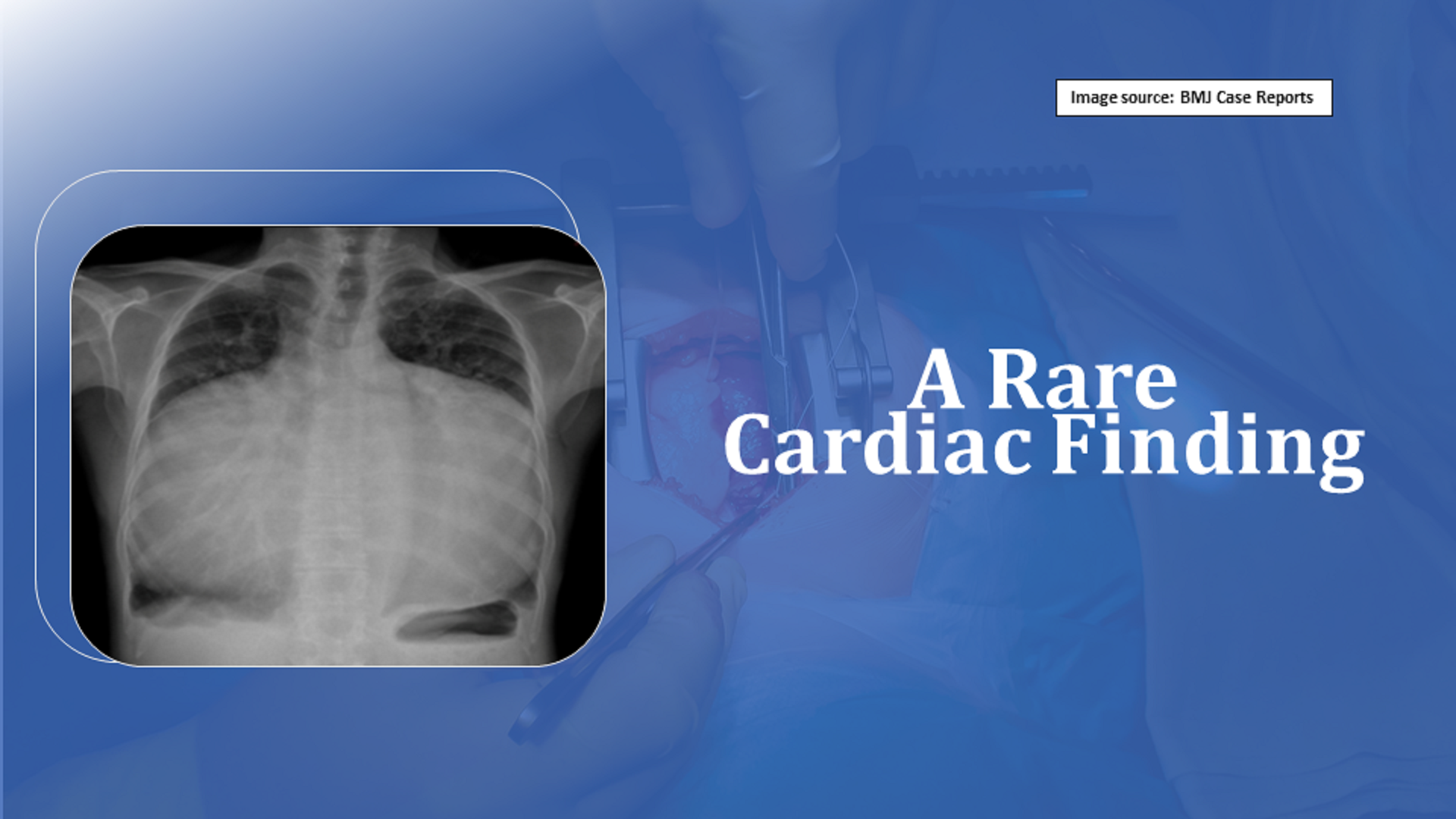What Does This  X-ray Suggest?
