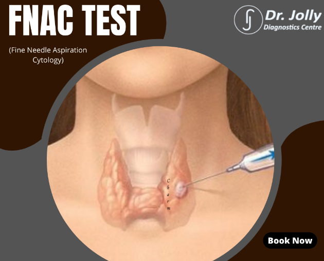Fine Needle Aspiration Cytology (FNAC) Test