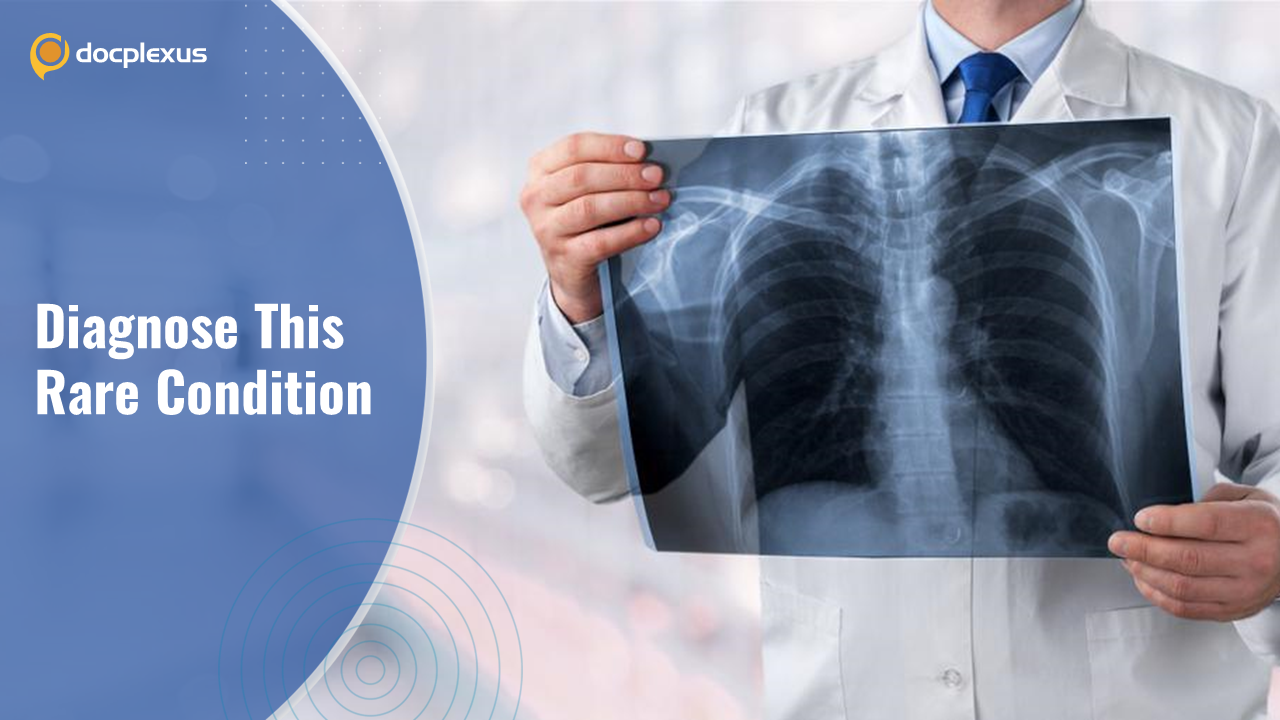 Identify This Rare Form of Cancer