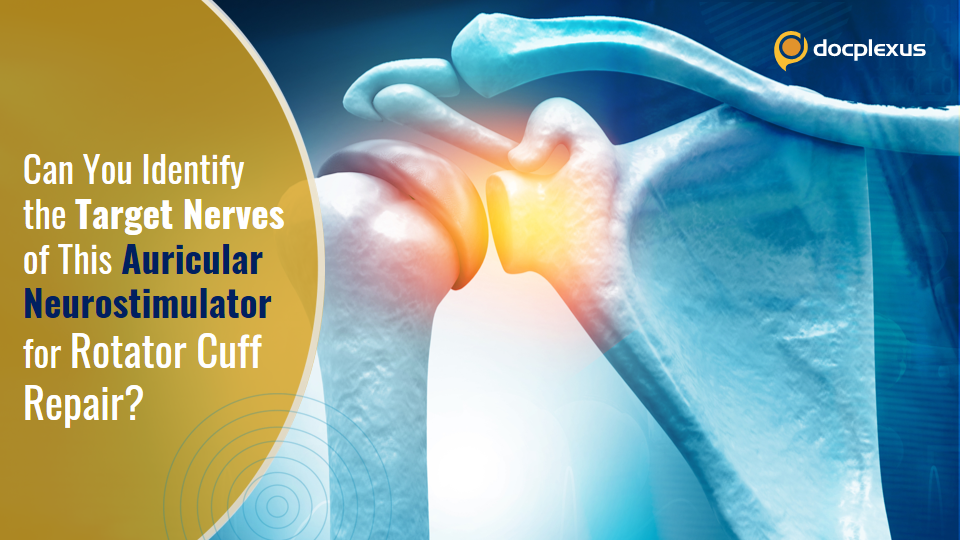 Analgesic Neurostimulator for Rotator Cuff Repair Pain Management
