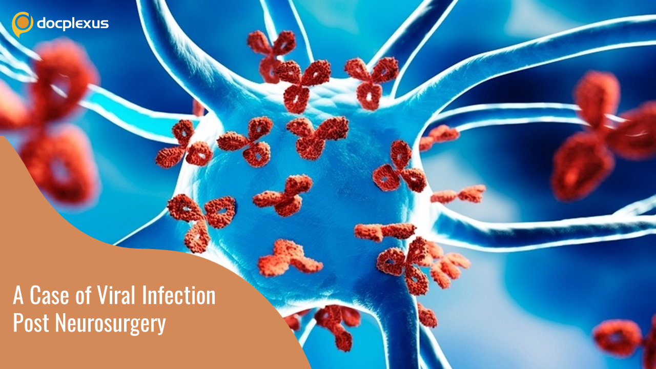 Reactivation of HSV After Surgery: A Case Study