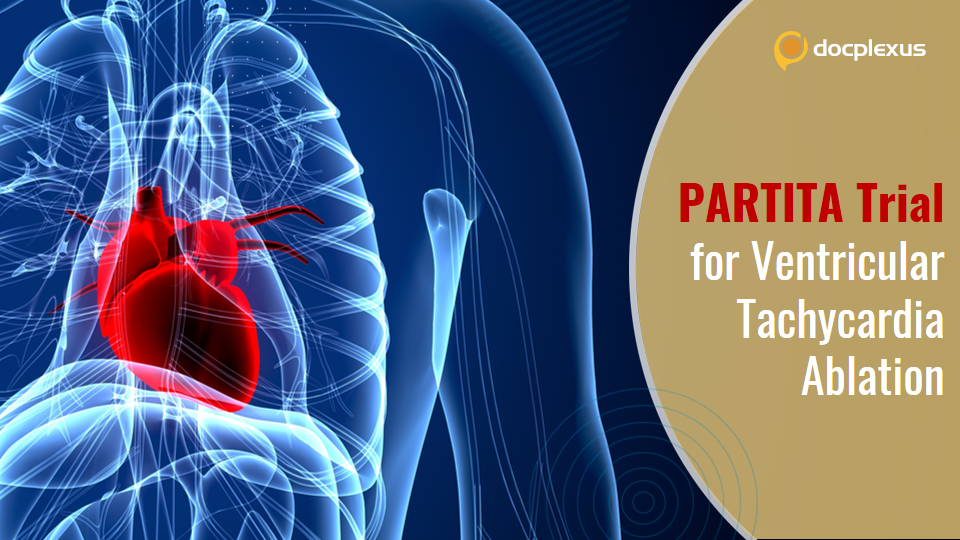 RCT to Establish the Benefits of Catheter Ablation in Ventricular Tachycardia