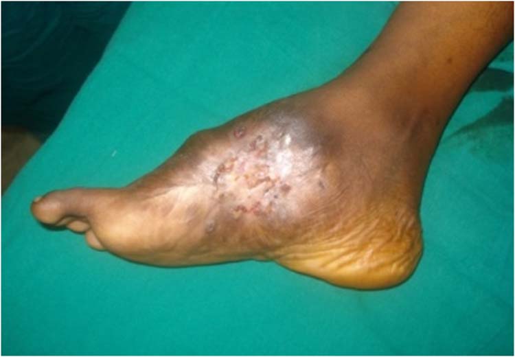 Can You Diagnose This Condition?