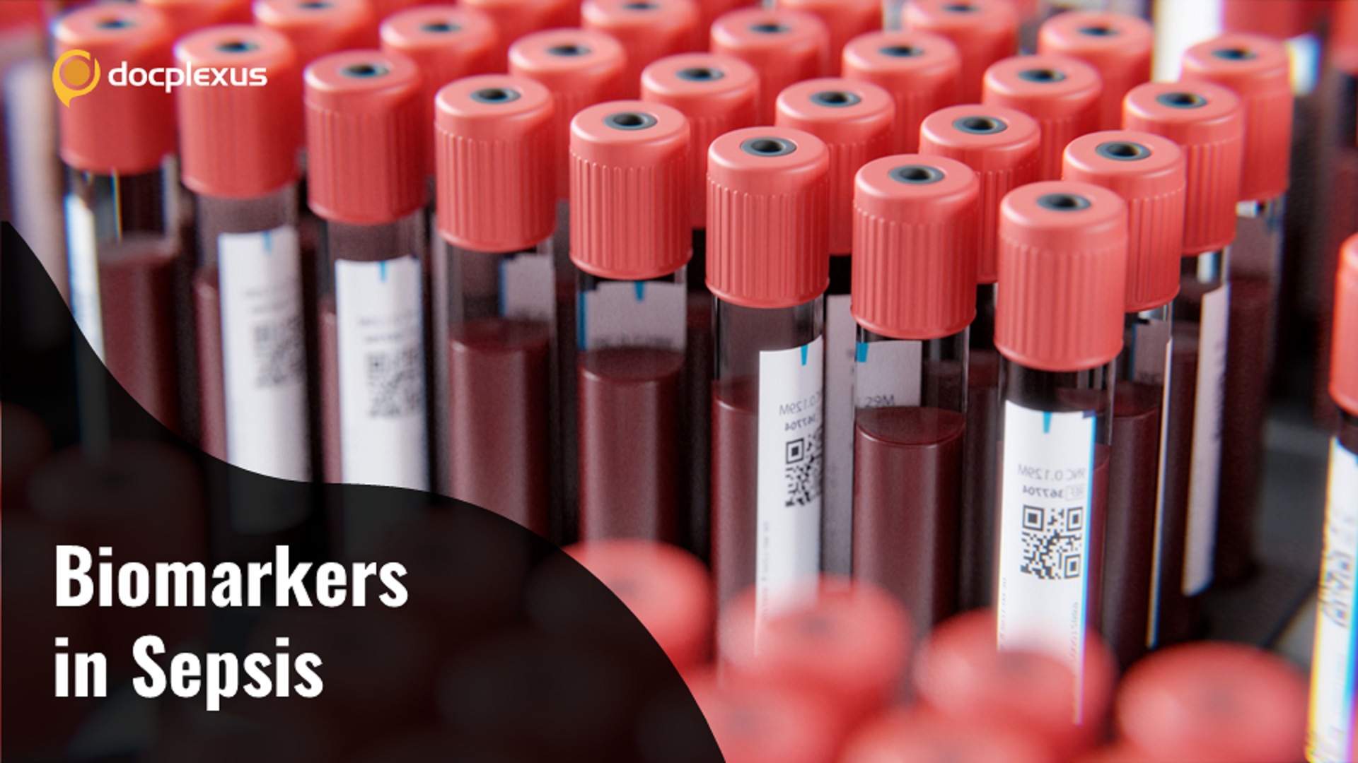 An Overview of Biomarkers in Sepsis