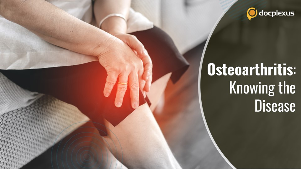 Osteoarthritis: What Patients Need to Know