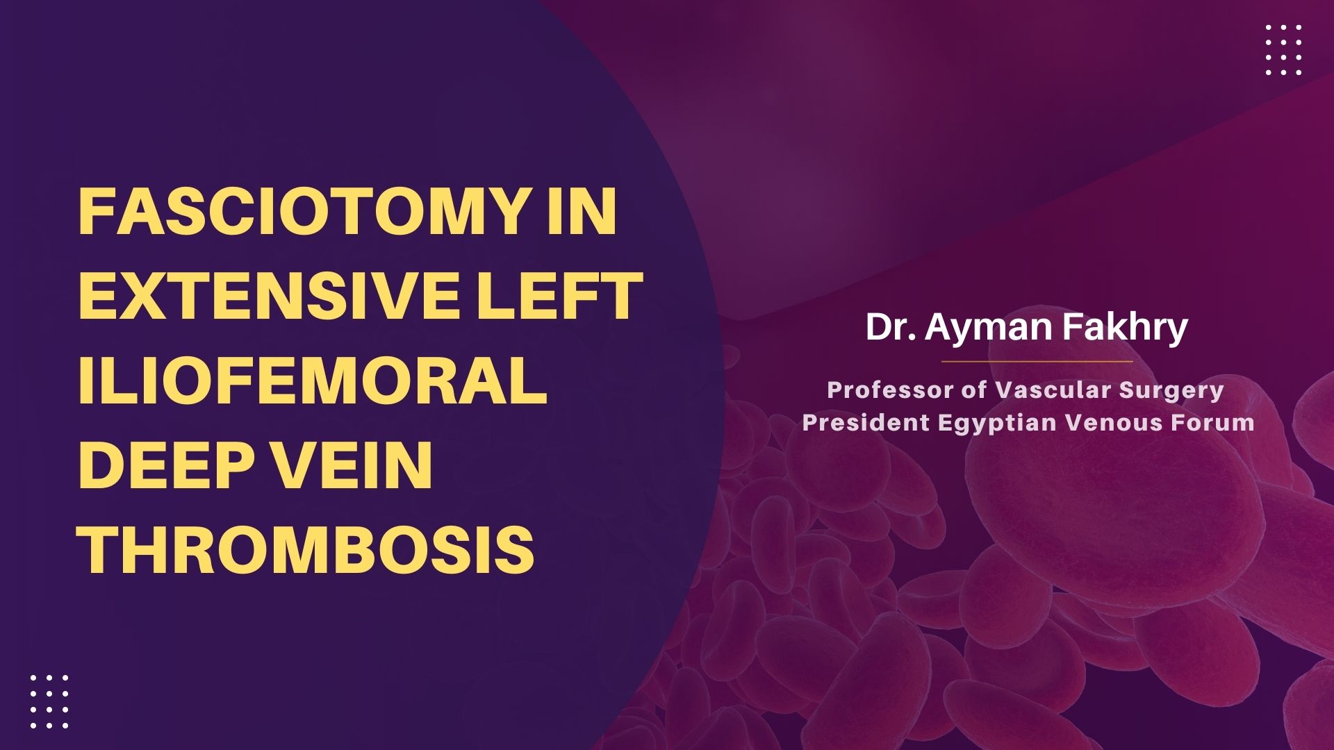 Fasciotomy In Extensive Left Iliofemoral Deep Vein Thrombosis – Case Report
