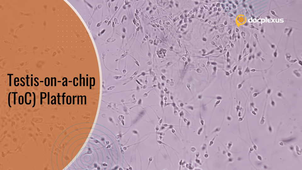 Testis-on-a-chip– A Novel In-vitro Spermatogenesis Device