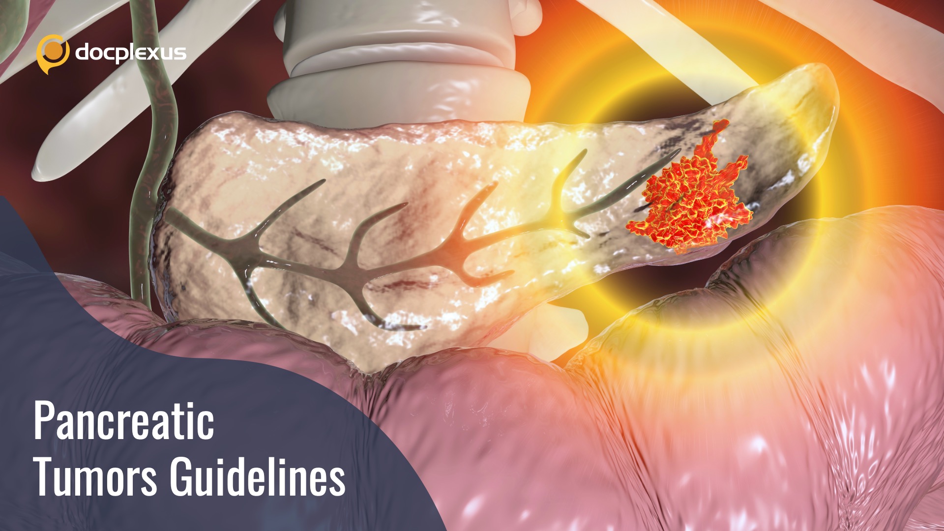 Pancreatic Tumors in Children