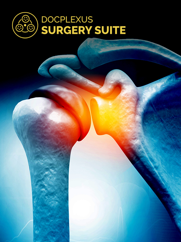 Shoulder Arthroscopy