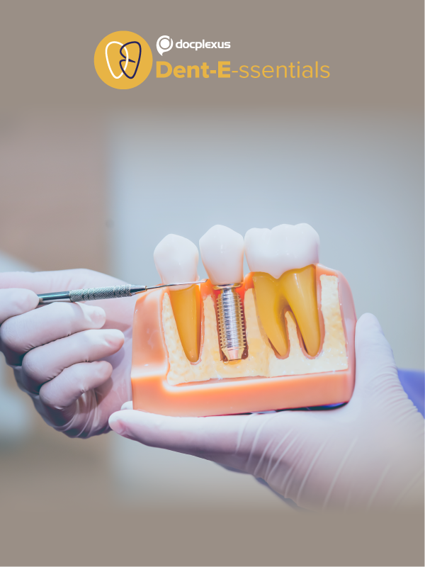 Oral Implantology: For Physicians and Surgeons (Part 2)