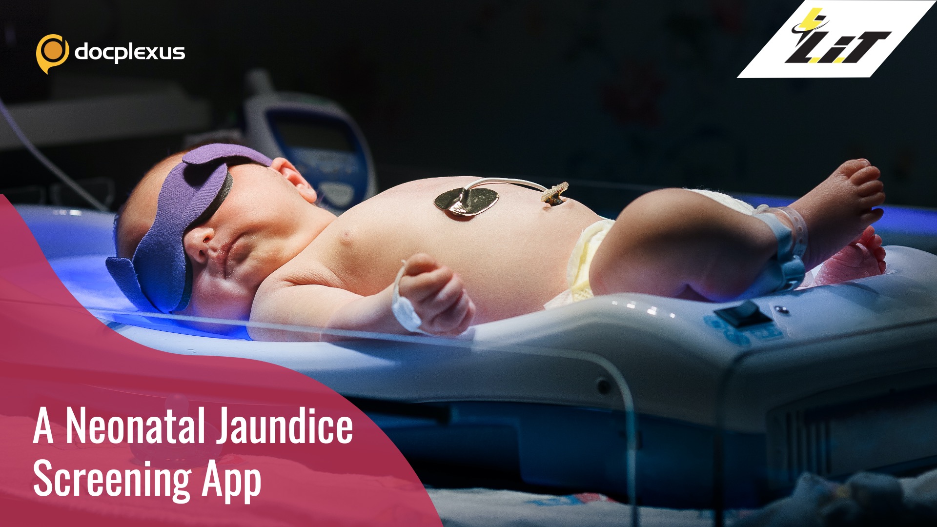 A Smartphone App for Screening of Neonatal Jaundice