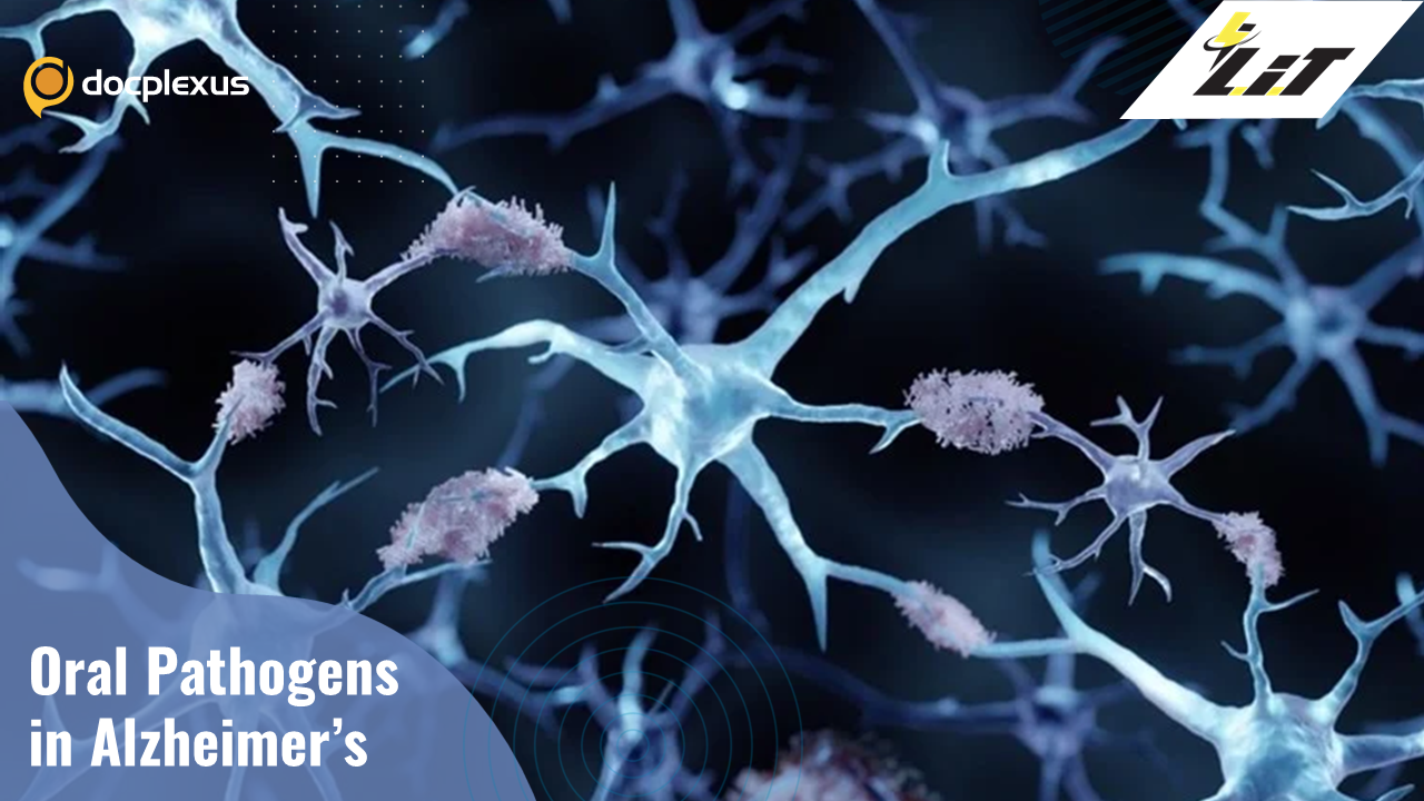 Periodontitis and Alzheimer’s Disease
