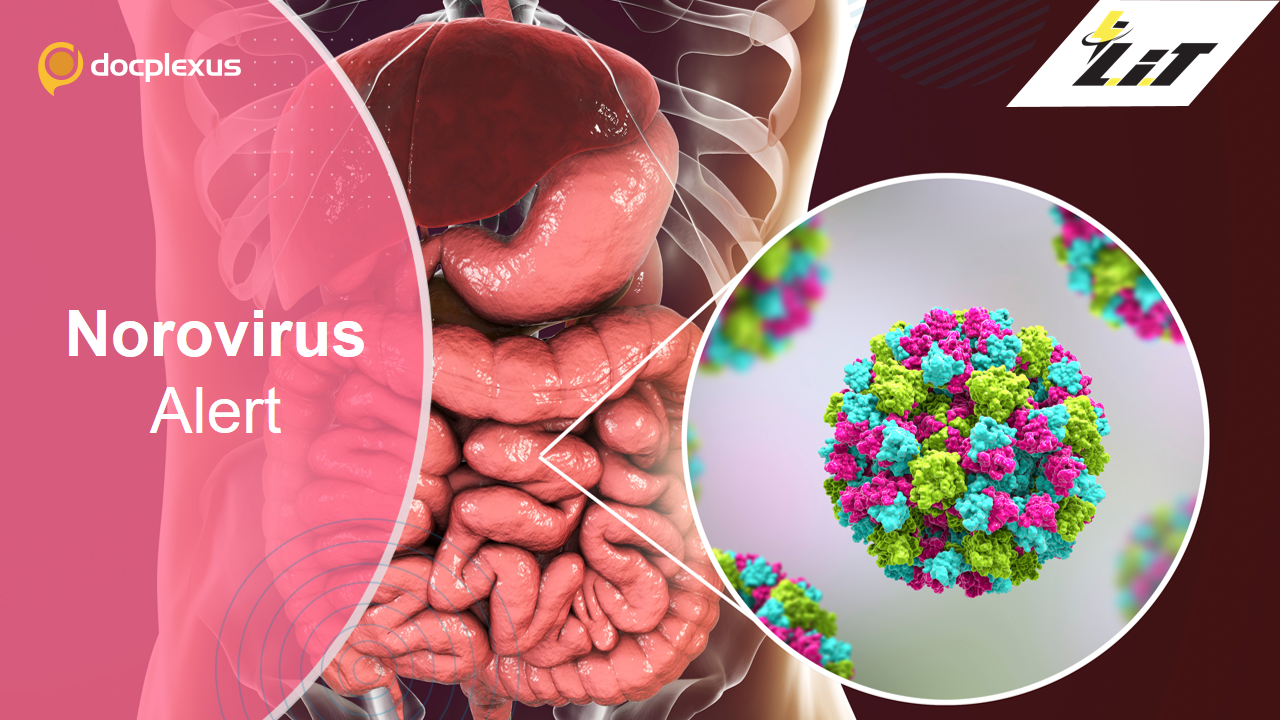 All About Norovirus and Its Outbreak