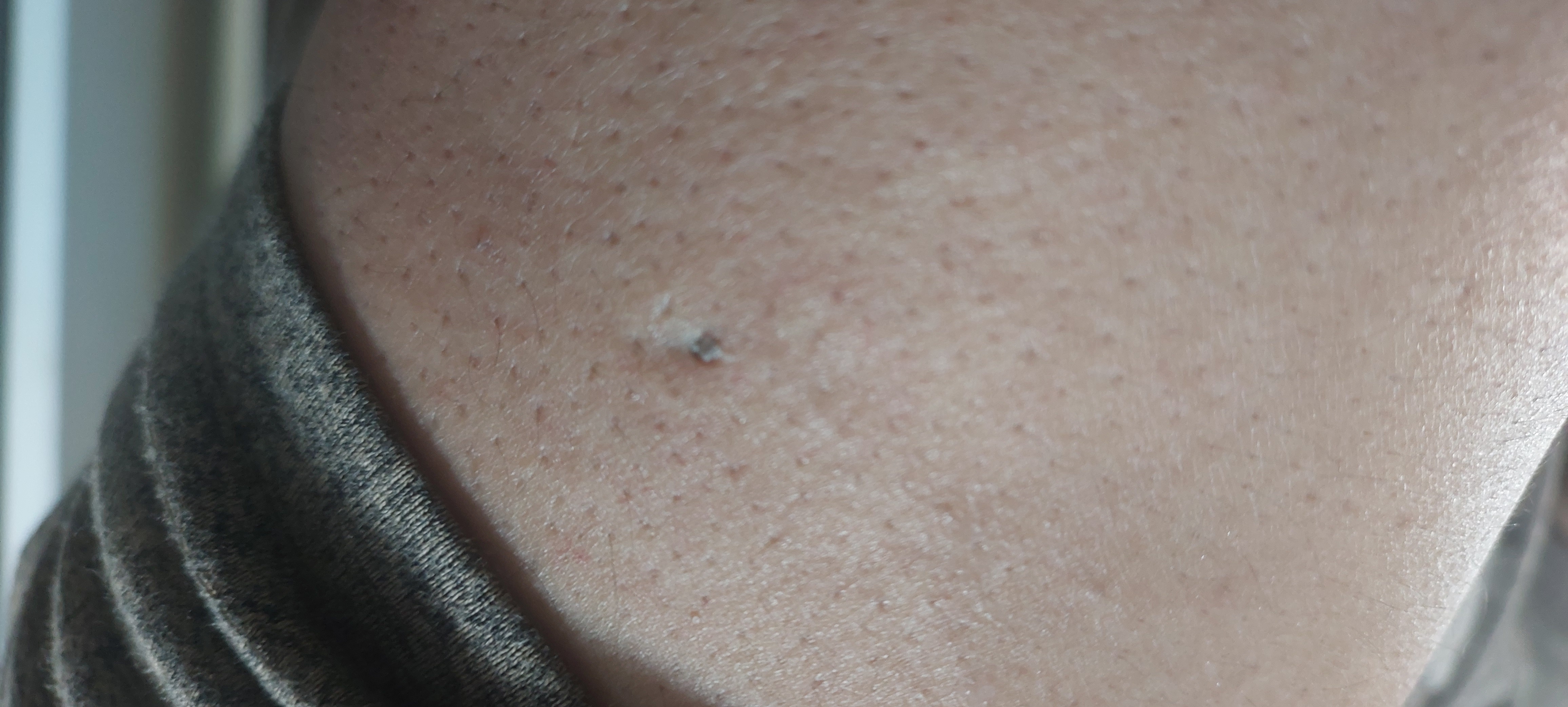 Can You Diagnose This Condition?