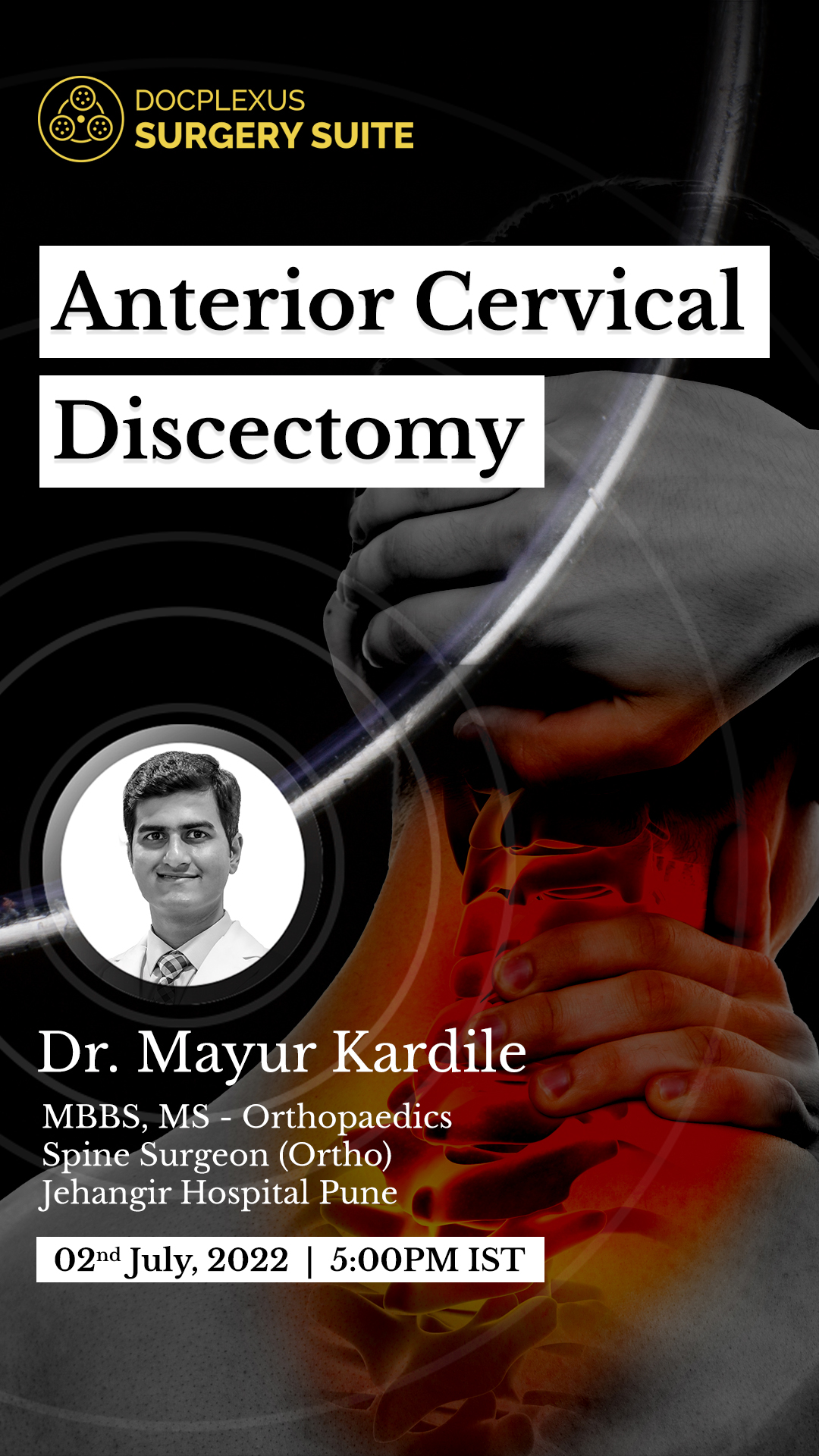 Anterior Cervical Discectomy